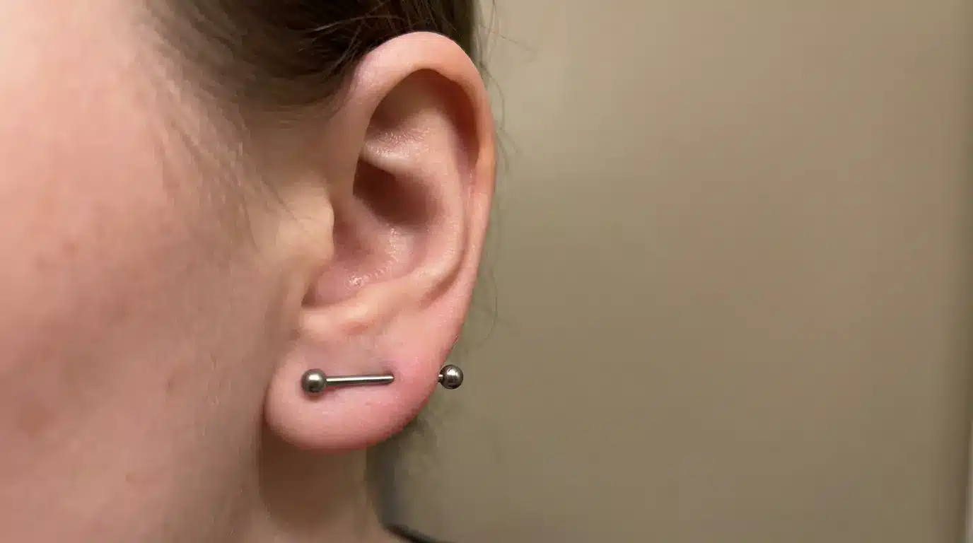 Ear with a transverse lobe piercing